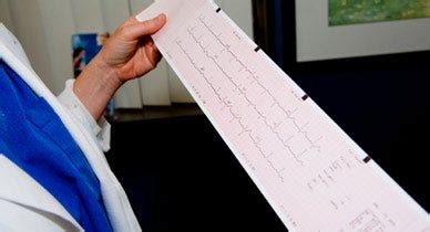 Abnormal EKG: What It Means and Treatment Options .